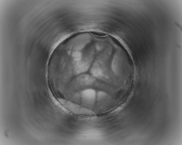 X0000099380957200805221802