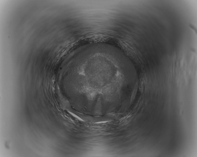 X0000099381010200805221800