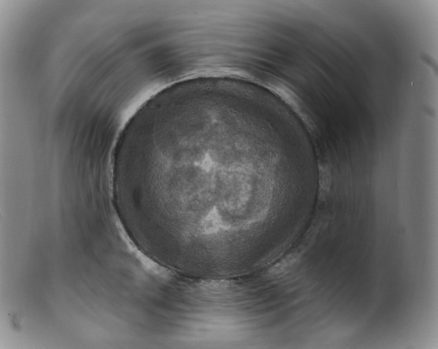 X0000099381046200805221801