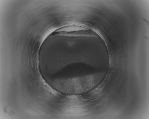 X0000099381048200805221801