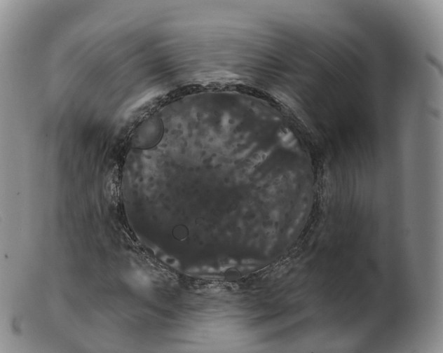 X0000099381063200805221800