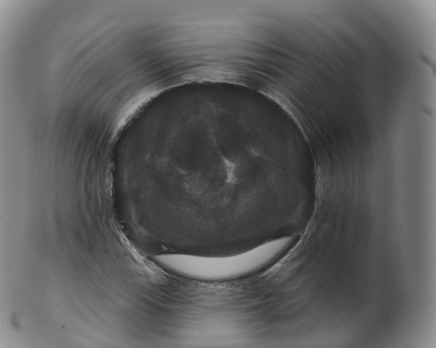 X0000099381115200805221759