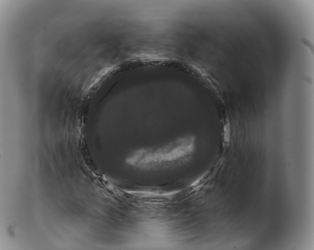 X0000099381157200805221759