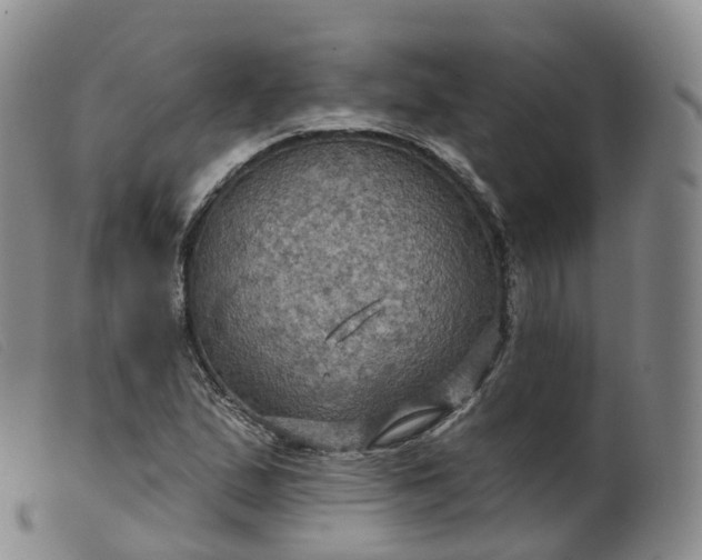 X0000099381167200805221758