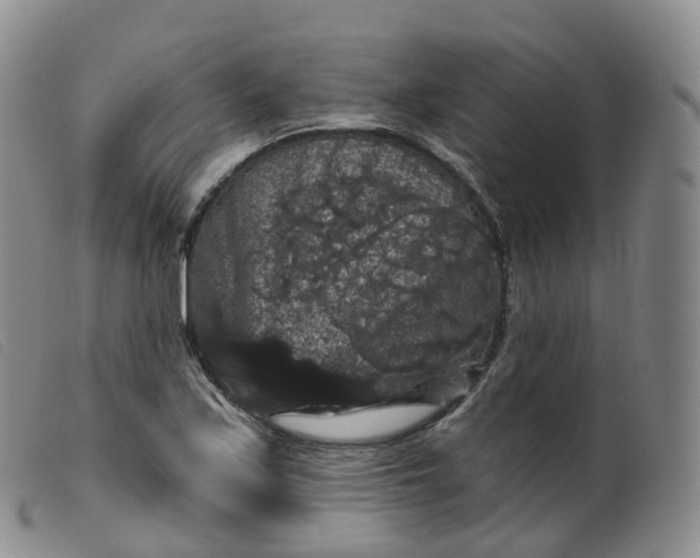 X0000099381171200805221758