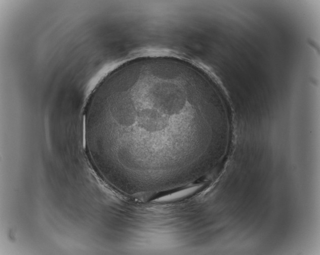 X0000099381175200805221758