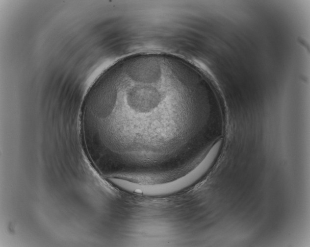 X0000099381183200805221758