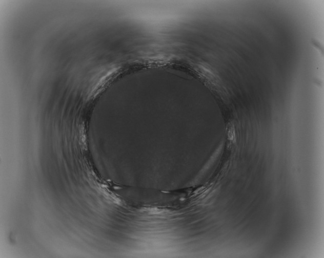 X0000099381252200805221757