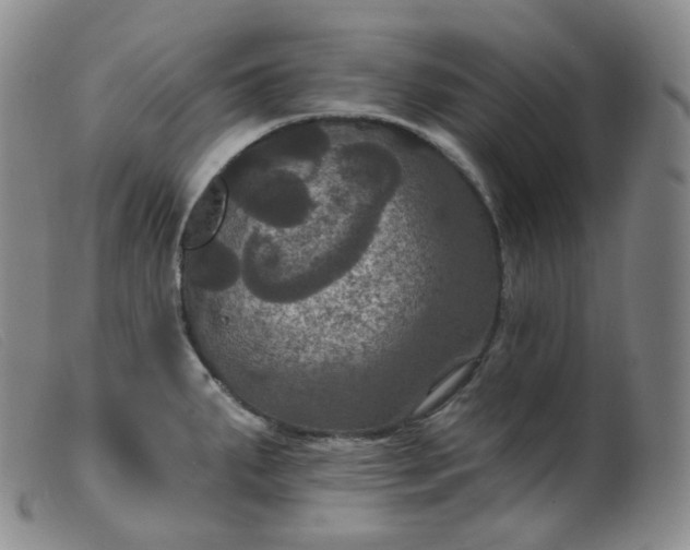 X0000099381287200805221757