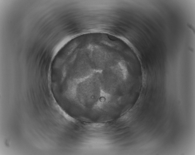 X0000099381294200805221757