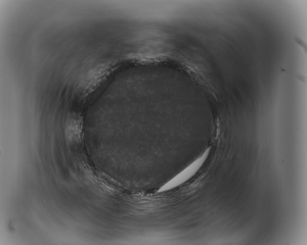 X0000099381300200805221756