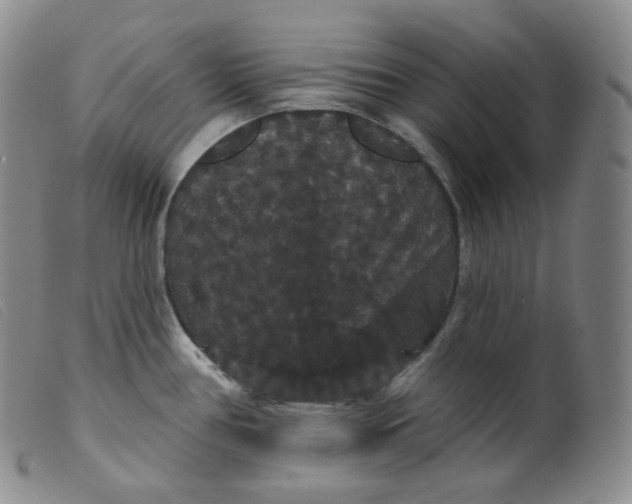 X0000099381386200805221755