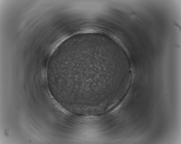 X0000099381417200805221755