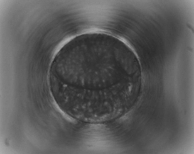 X0000099381429200805221755