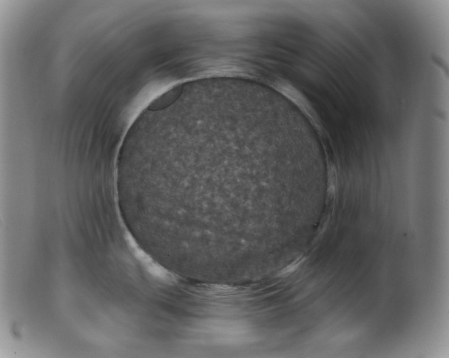 X0000099381439200805221755