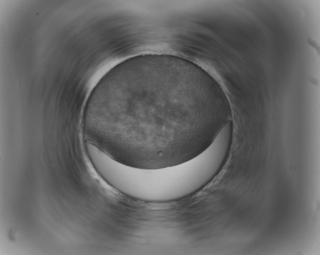 X0000099381440200805221755