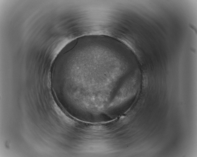 X0000099381468200805221754