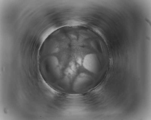 X0000099381487200805221754