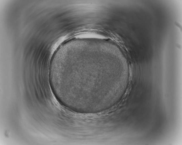 X0000099380003200805291138