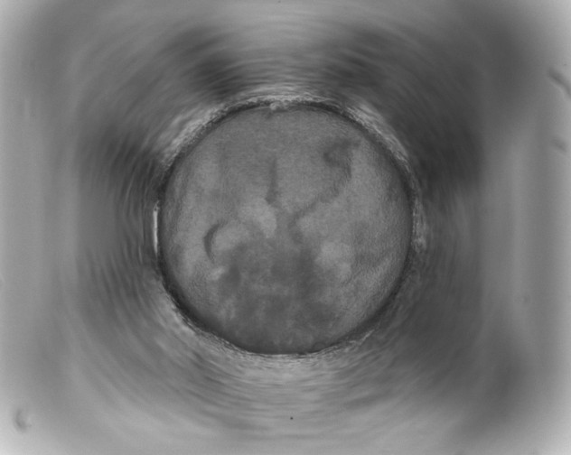 X0000099380014200805291138