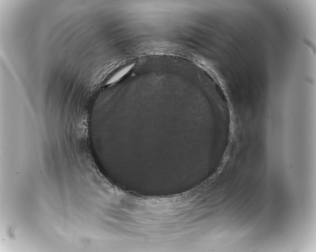 X0000099380017200805291138