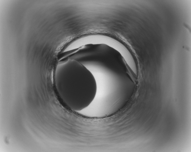 X0000099380019200805291138