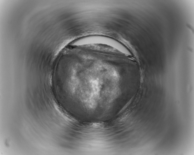 X0000099380060200805291137