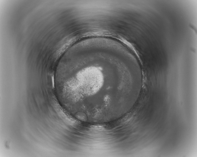 X0000099380061200805291137
