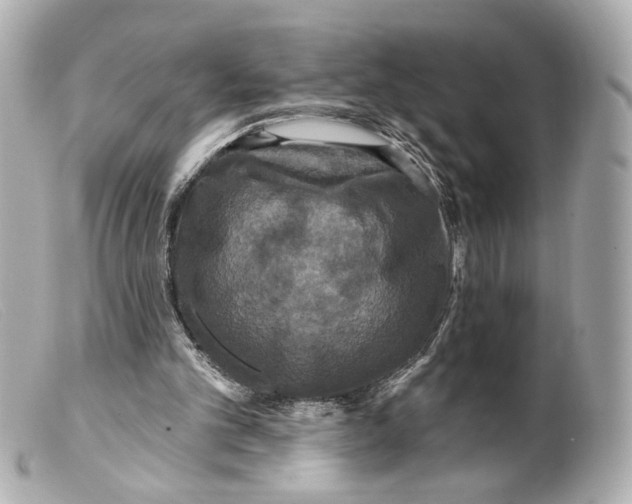 X0000099380101200805291137