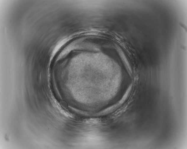 X0000099380102200805291137