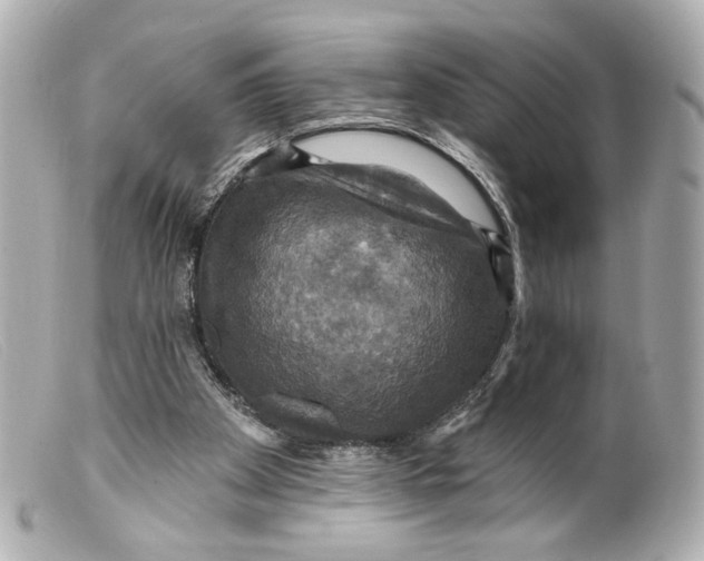 X0000099380105200805291137