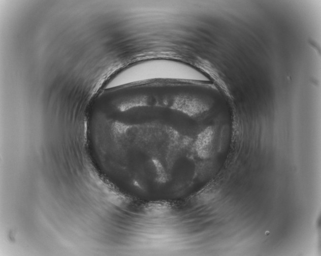 X0000099380110200805291136
