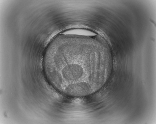 X0000099380111200805291136