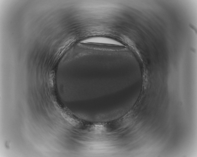 X0000099380114200805291136
