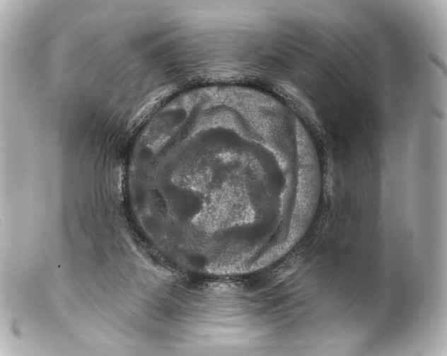 X0000099380115200805291136