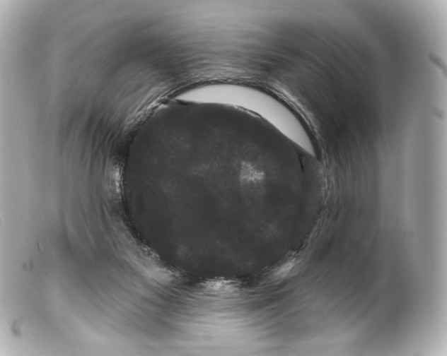 X0000099380117200805291136