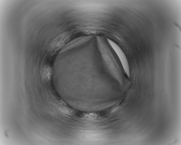 X0000099380125200805291136