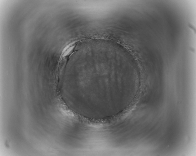 X0000099380144200805291136