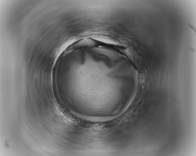 X0000099380148200805291135