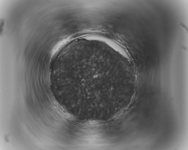 X0000099380149200805291135