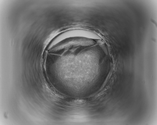 X0000099380152200805291136