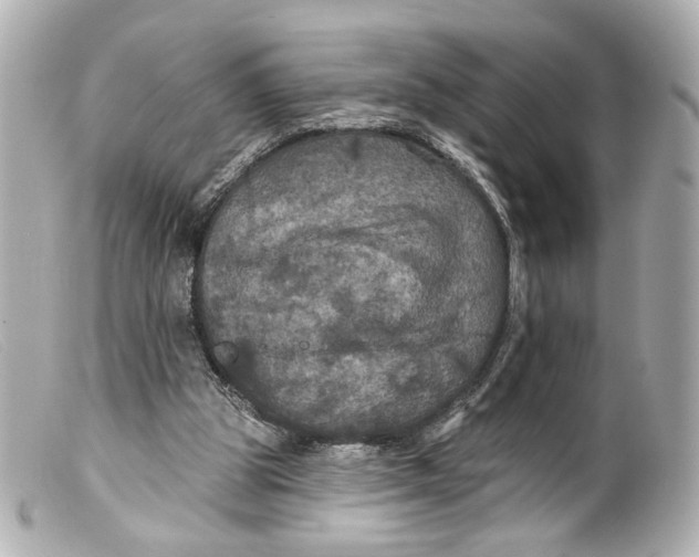 X0000099380153200805291136