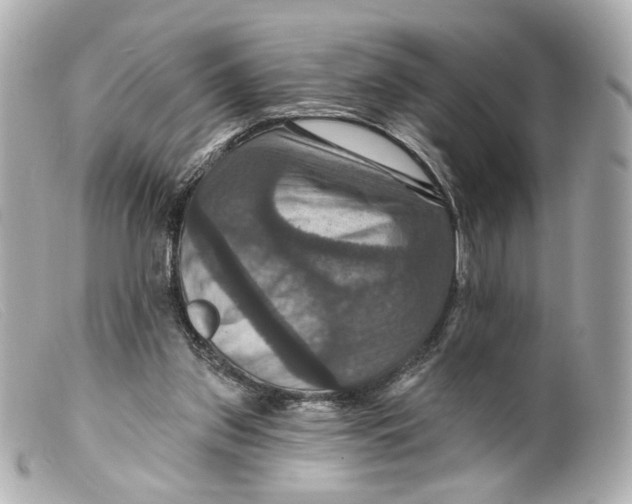 X0000099380157200805291136