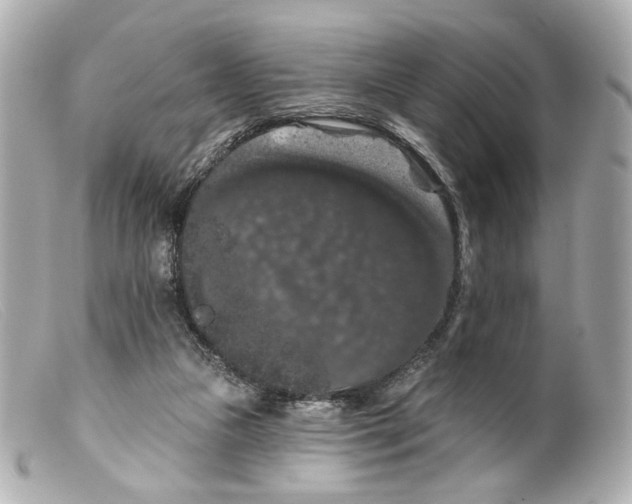 X0000099380161200805291136