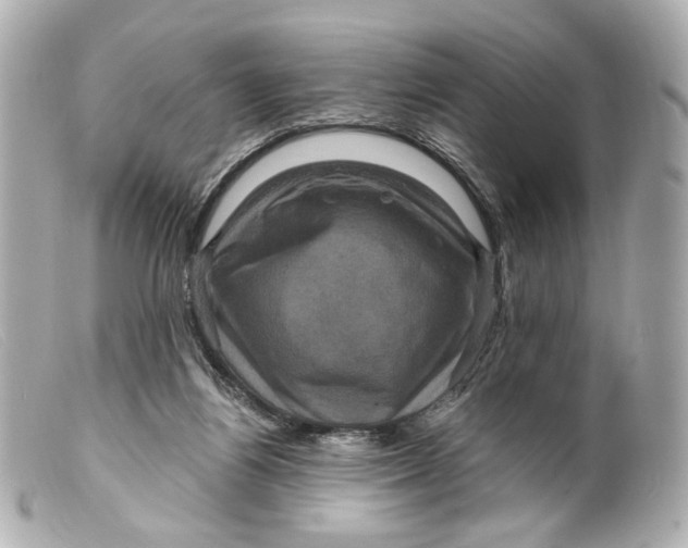 X0000099380164200805291136