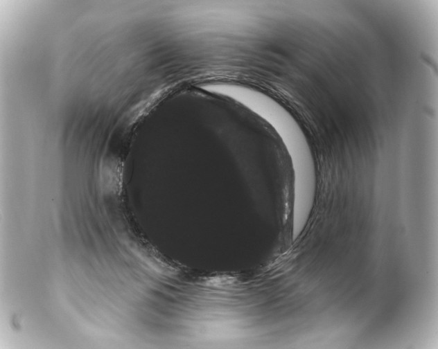 X0000099380168200805291136
