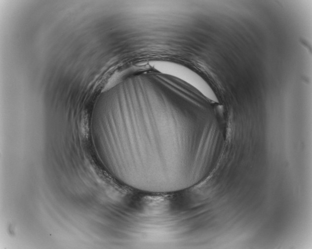 X0000099380170200805291136