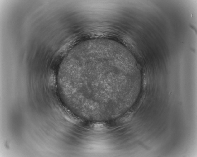 X0000099380173200805291136