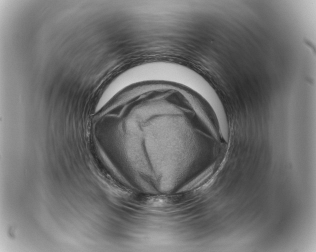 X0000099380174200805291136
