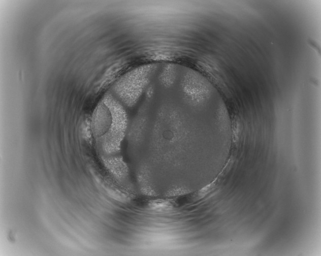 X0000099380175200805291136